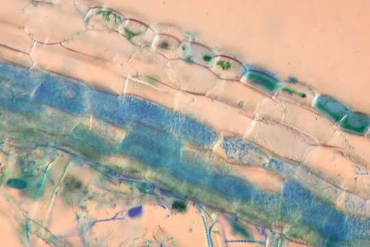 Querschnitt durch ein Lebermoos