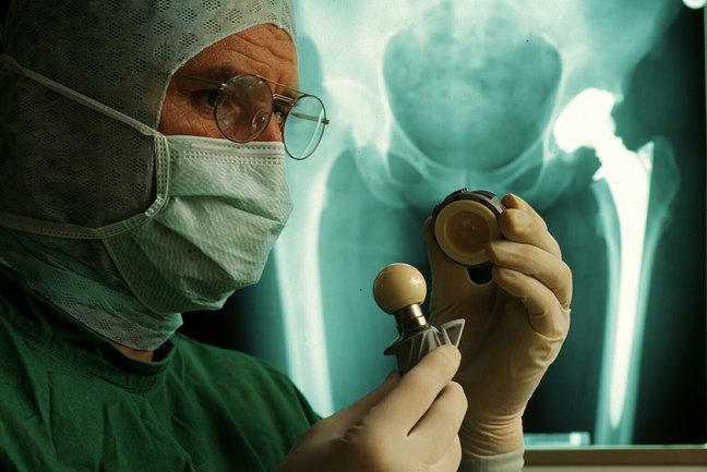 Arzt hält künstliches Hüftgelenk in den Händen