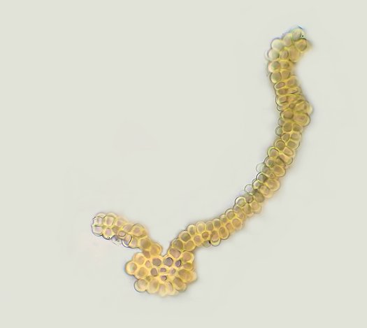 Mikroskopbild von Seetang der Art Codium mamillosum